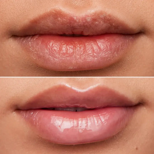 Wonderskin Lip Rehab Serum Oil