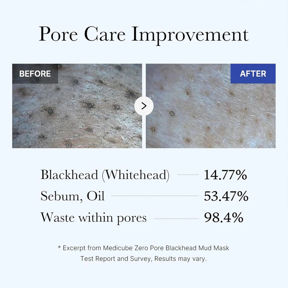Medicube Zero Pore Mud Mask